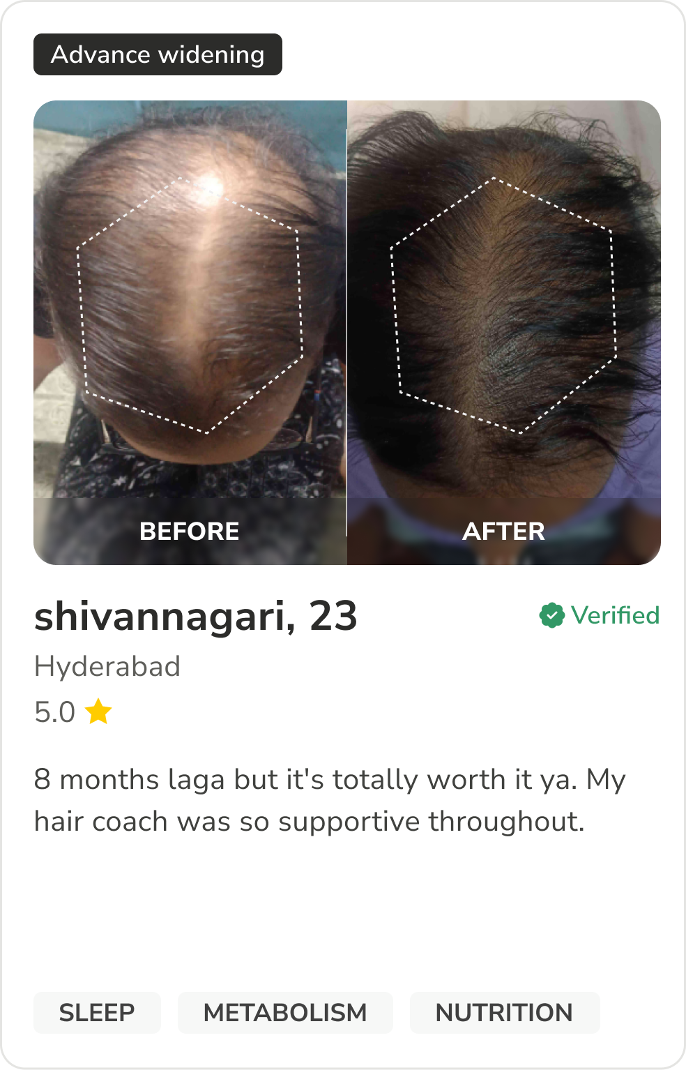 Month 1 Hair Progress