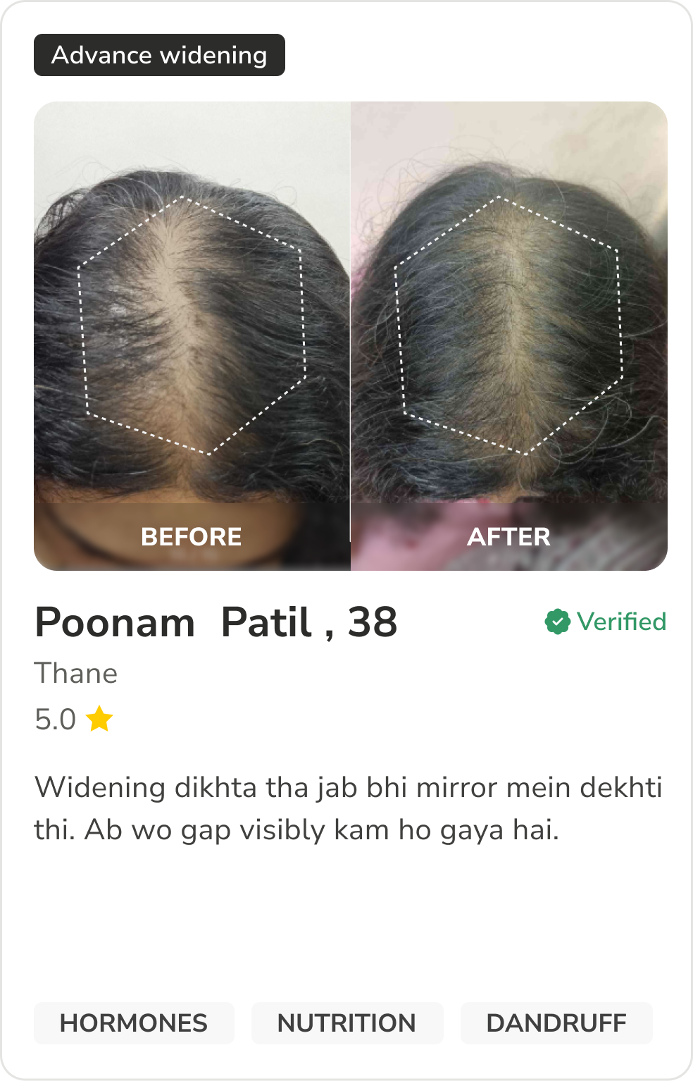 Month 1 Hair Progress