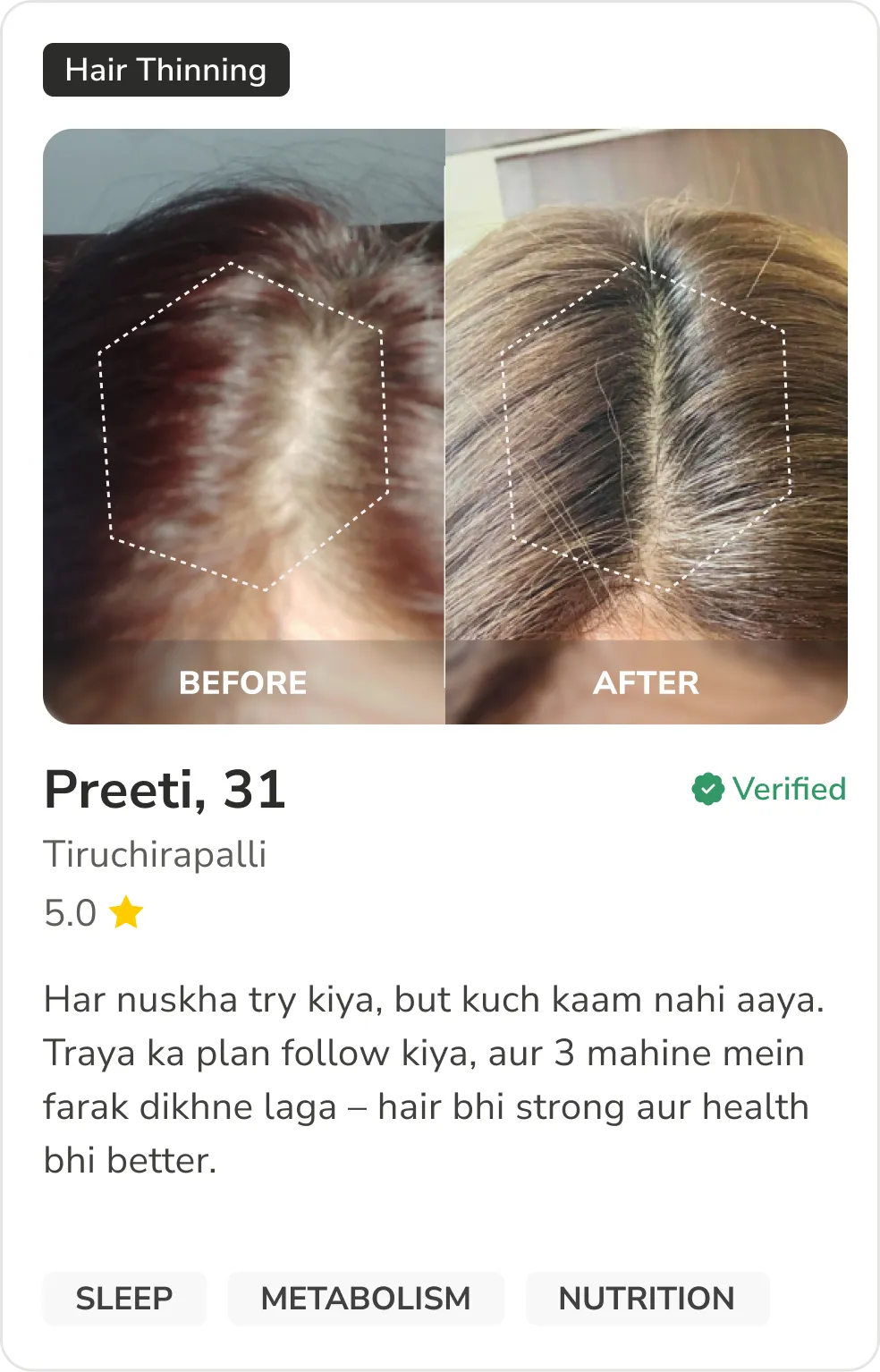 Month 1 Hair Progress