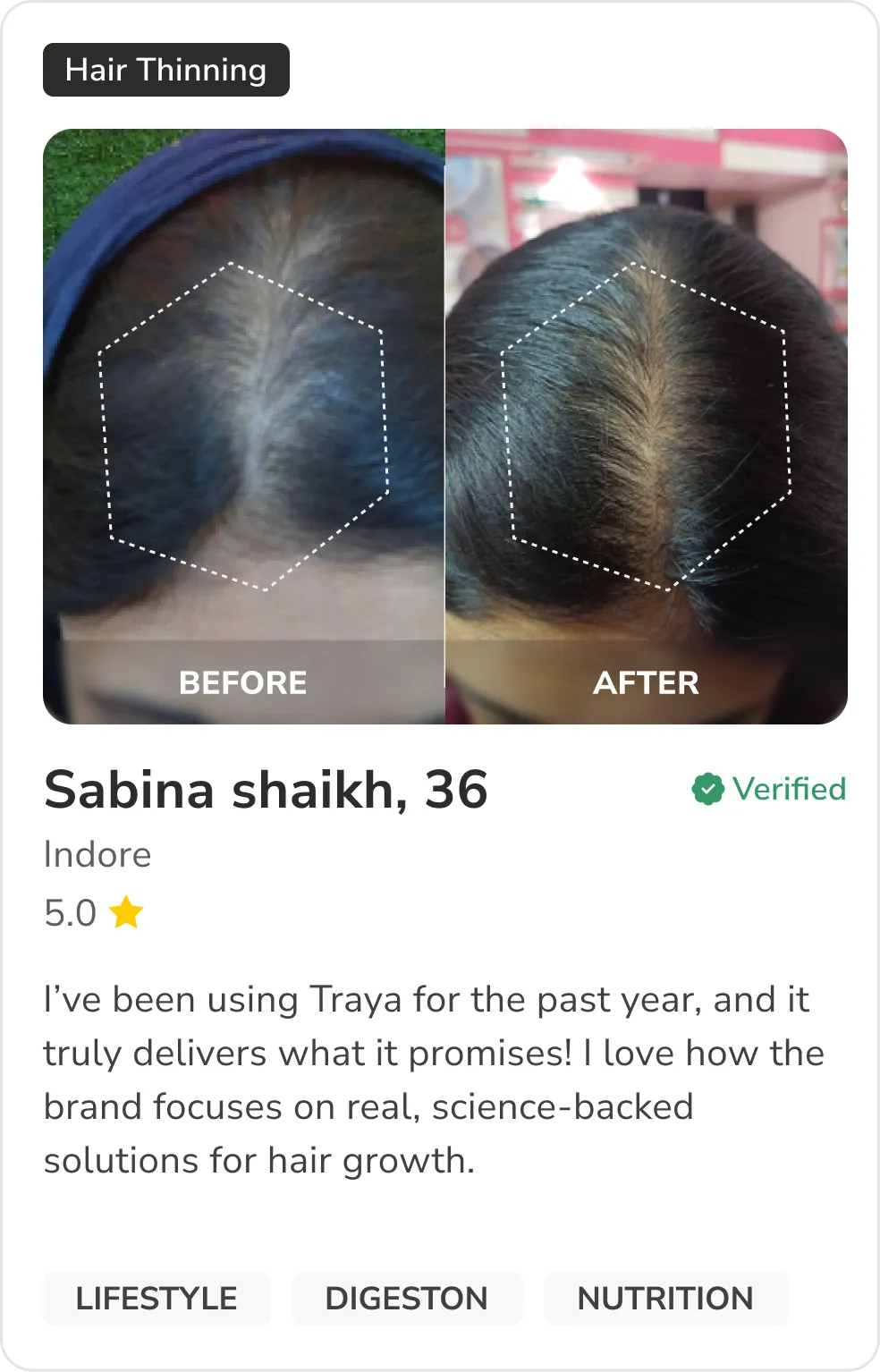 Month 1 Hair Progress