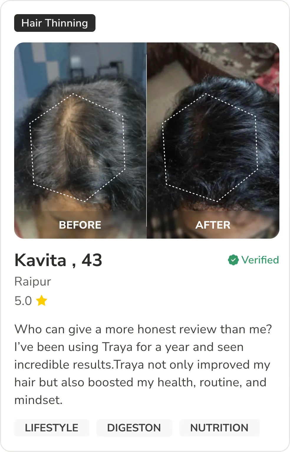 Month 1 Hair Progress