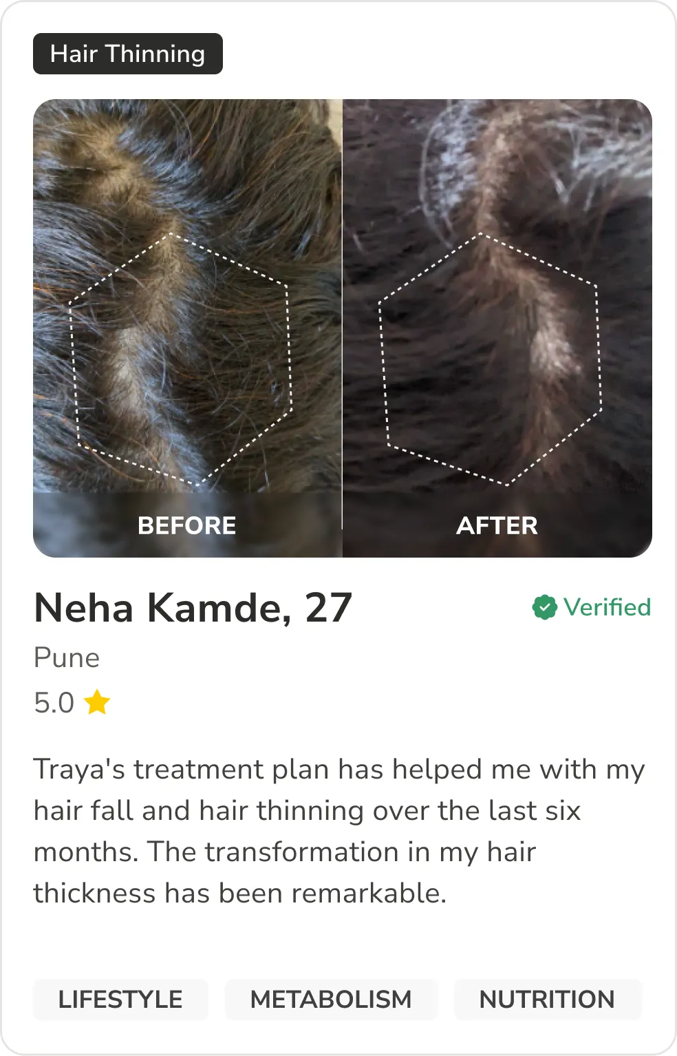 Month 1 Hair Progress