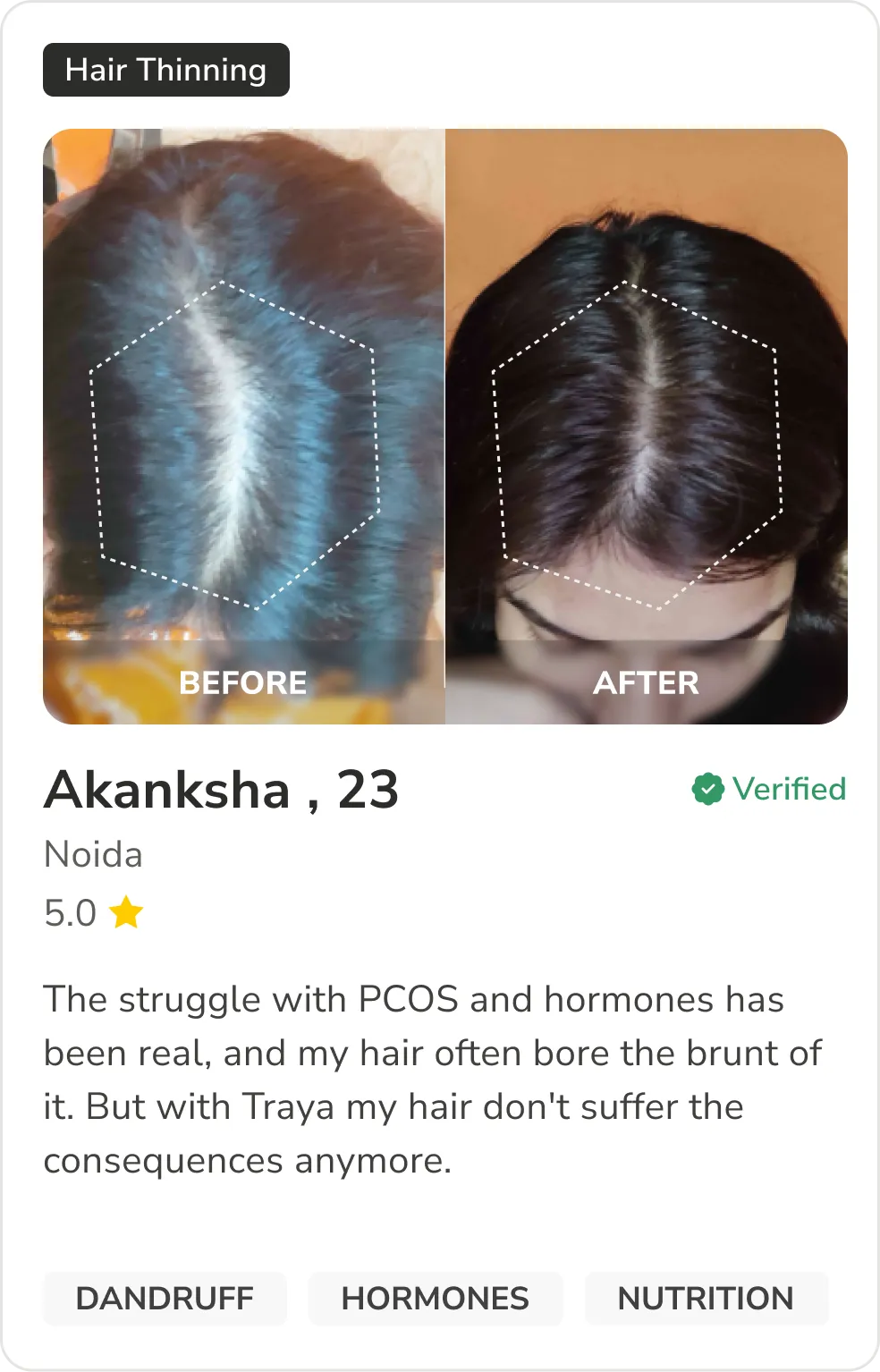 Month 1 Hair Progress