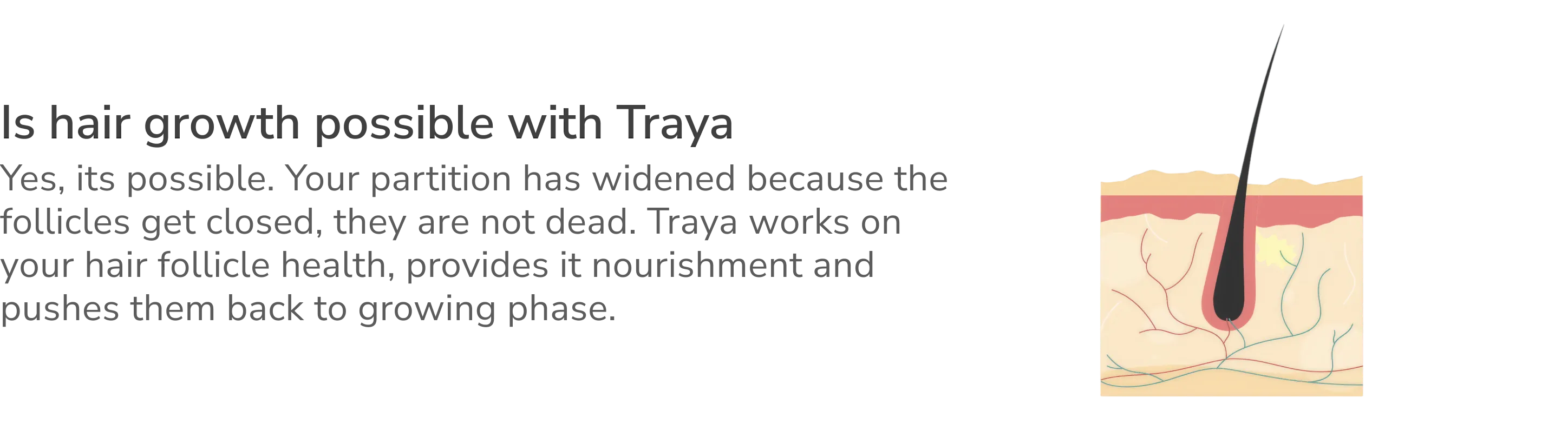 How Traya works