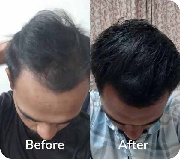 See growth in 6-8 months
