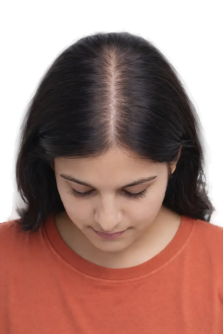 Less volume, no visible thinning